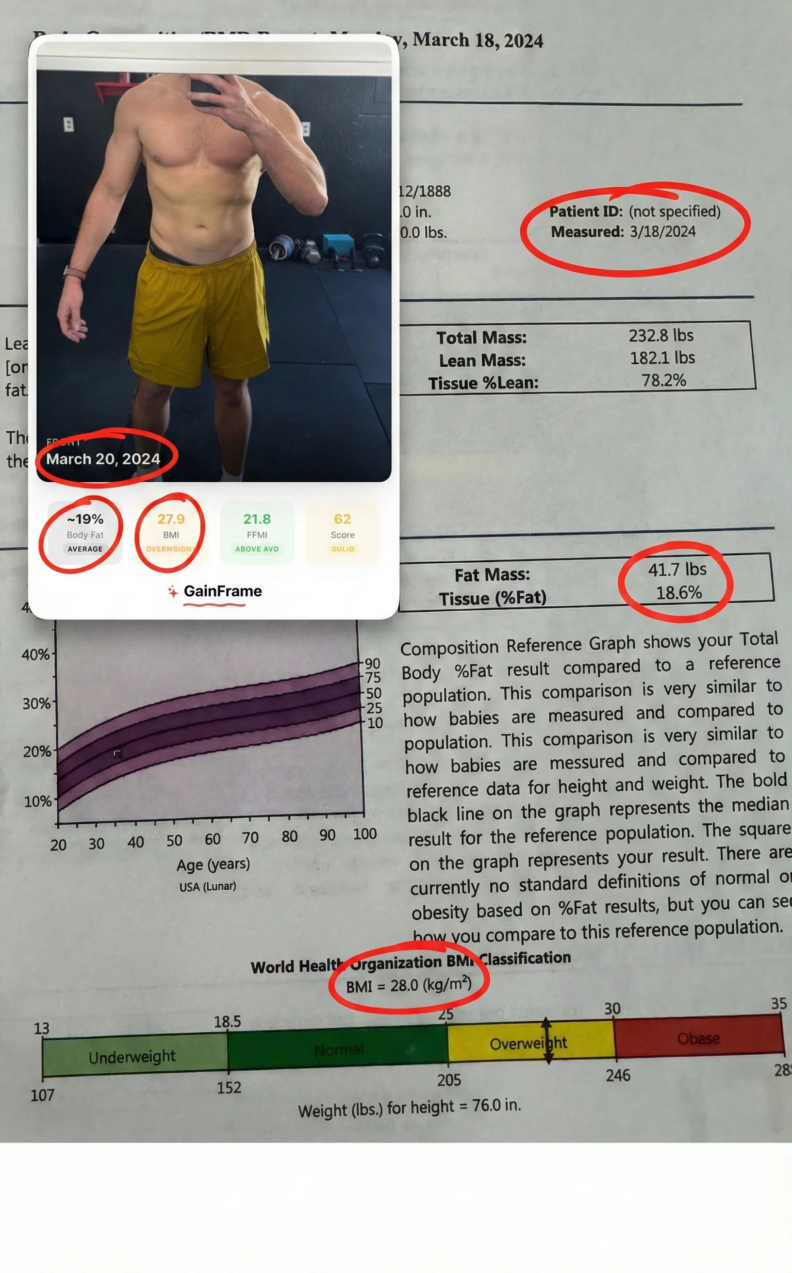 DEXA scan result compared to AI body composition analysis side by side
