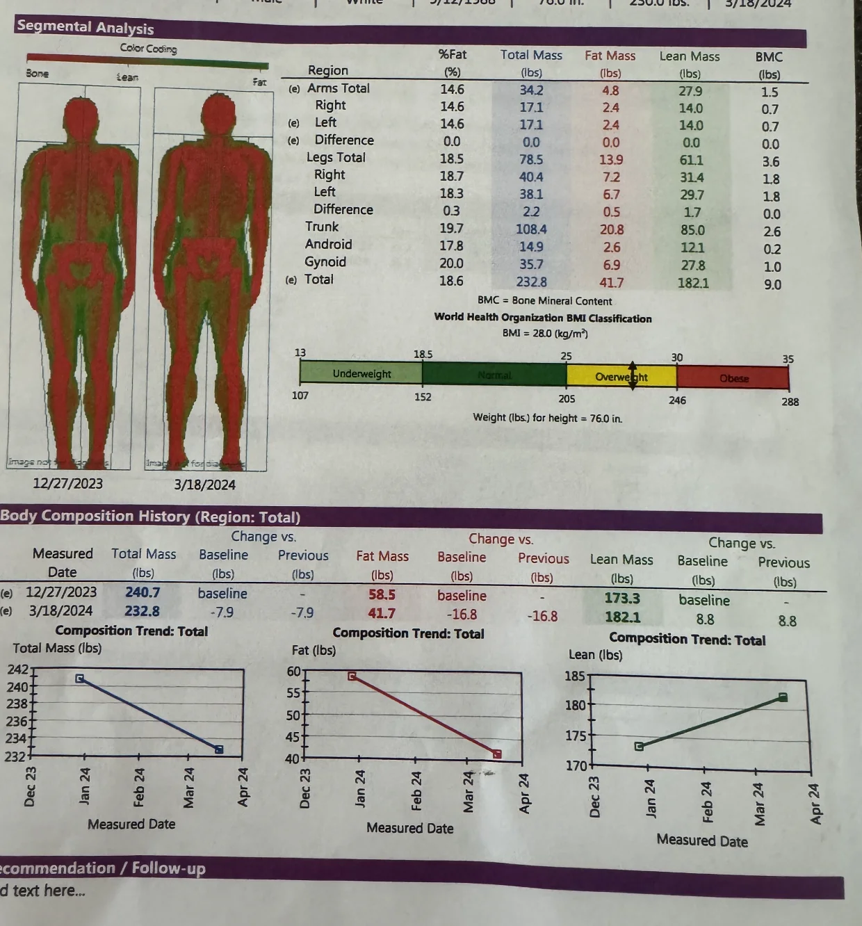DEXA scan showing regional body lean mass distribution emphasizing arm symmetry